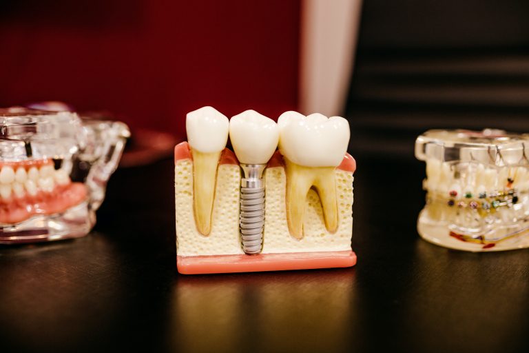 a dental model of teeth